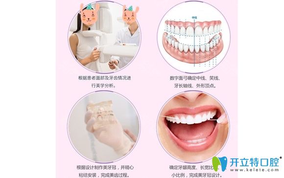 <!--<i data=20240703-sp></i>-->圣貝口腔牙齒修復(fù)特色圖