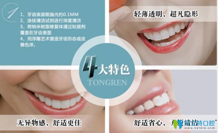 7D牙齒美白技術(shù)優(yōu)勢