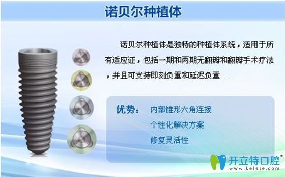 諾貝爾種植體優(yōu)勢(shì)宣傳圖