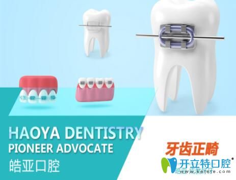 蘭州牙齒矯正哪里價格便宜?皓亞口腔金屬托槽正畸不到4千哦