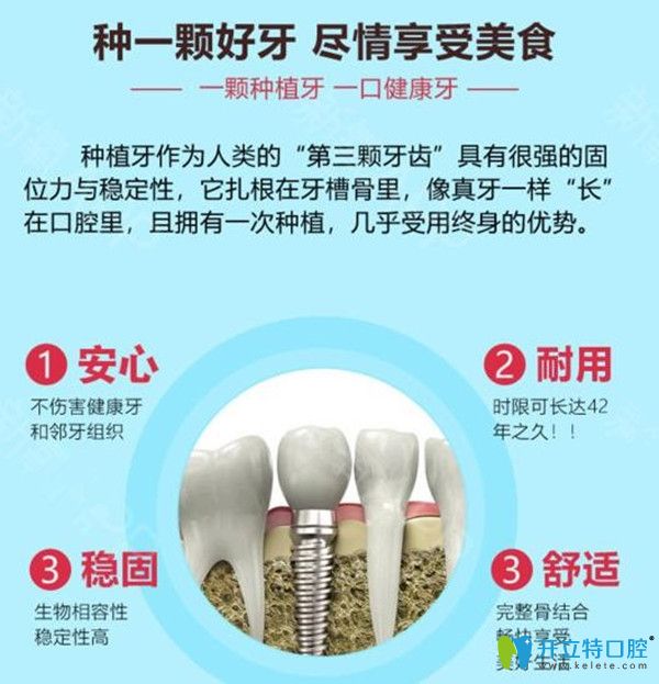 種植牙的優(yōu)勢