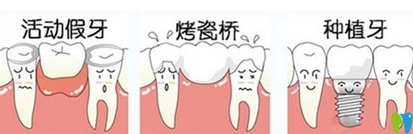 種植牙與其他修復技術(shù)相比更具優(yōu)勢