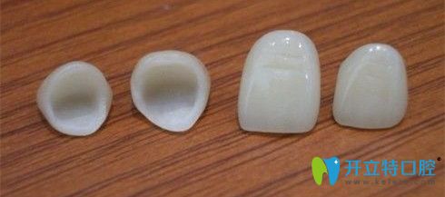 威蘭德全瓷牙與則武全瓷牙區(qū)別