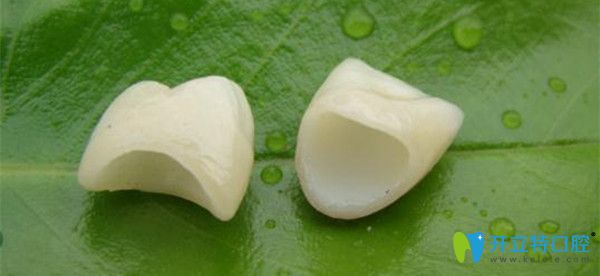 日本則武全瓷牙好嗎