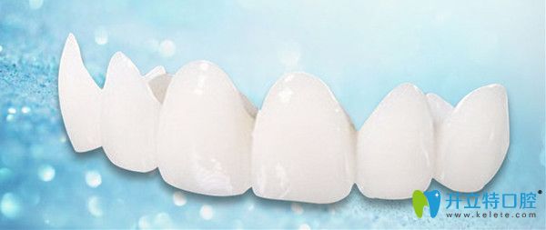 日本則武全瓷牙價(jià)格