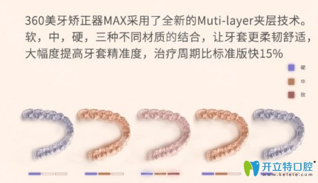 國產(chǎn)360美牙隱形牙套圖片