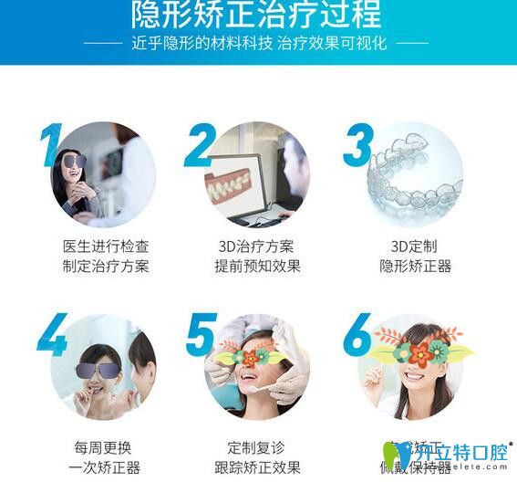 蘇州康美口腔隱形牙齒矯正過(guò)程