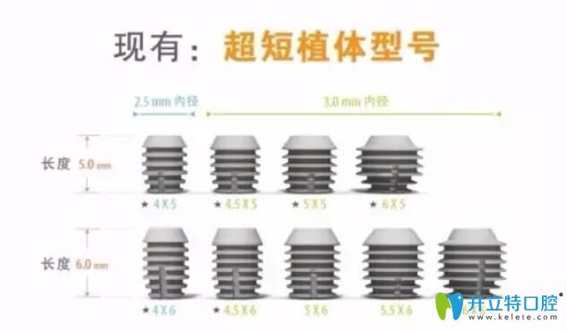 韓國多普勒種植體型號(hào)
