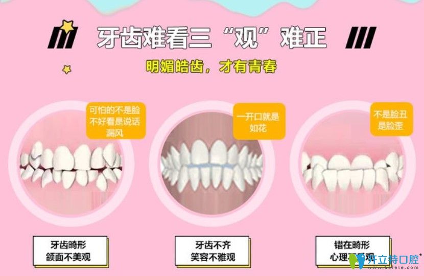 雙11來(lái)佳美口腔隱形矯正讓你不知不覺(jué)中變