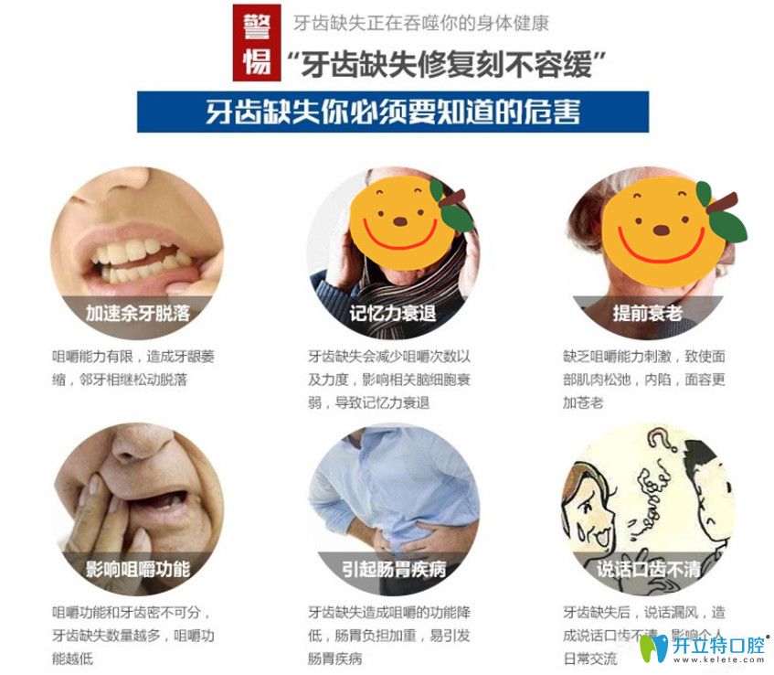 佳美口腔為缺牙父母獻(xiàn)禮種牙價(jià)格鉅惠來(lái)襲