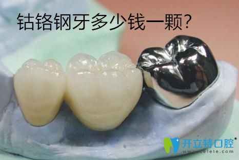 鈷鉻鋼牙多少錢一顆？分享鈷鉻鋼牙套的價格及優(yōu)缺點