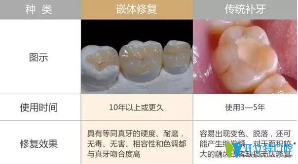 嵌體和補(bǔ)牙的區(qū)別