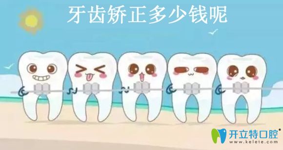 聽說深圳港龍醫(yī)院口腔科固定矯正和隱形矯正價(jià)格很親民哦!