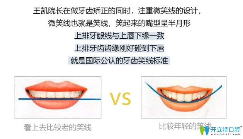 牙齒矯正也會(huì)改變臉型