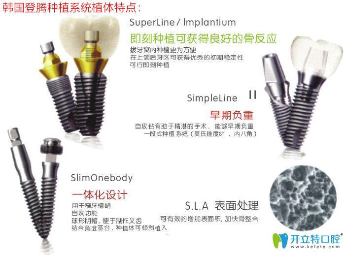 登騰種植系統(tǒng)植體特點(diǎn)