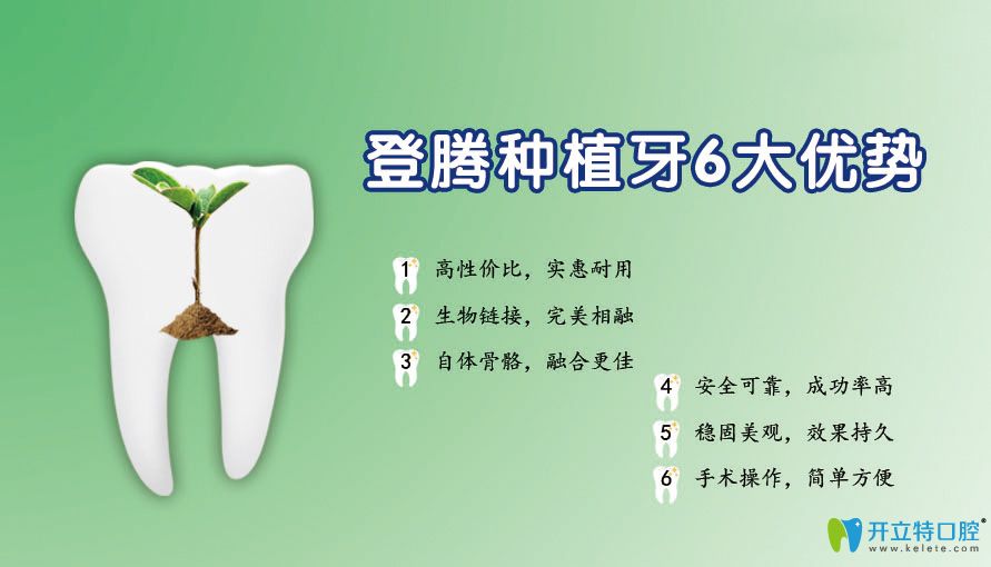 登騰種植牙6大優(yōu)勢(shì)