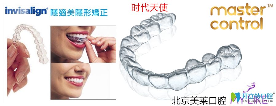 北京美萊口腔隱形矯正圖示