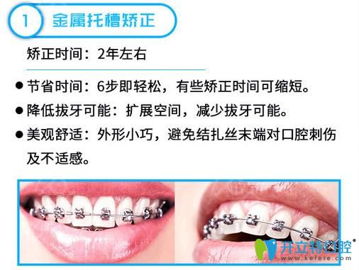 金屬托槽矯正