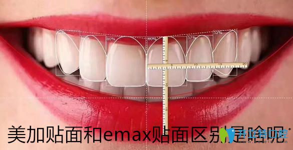 瓷貼面品牌千千萬，帶你了解美加貼面和emax貼面區(qū)別是啥