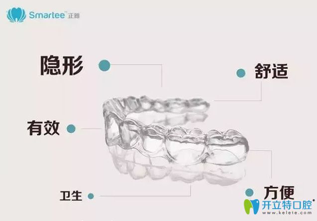 正雅隱形矯正牙套優(yōu)點(diǎn)