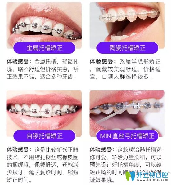 <!--<i data=20240703-sp></i>-->永華口腔牙齒矯正項(xiàng)目