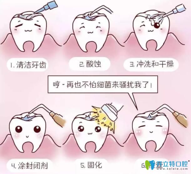 窩溝封閉