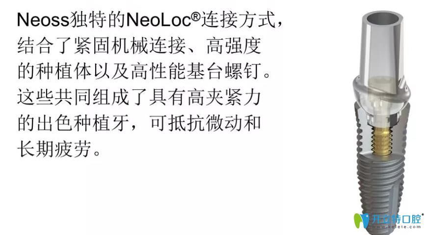 瑞典N(xiāo)eoss種植體優(yōu)勢(shì)