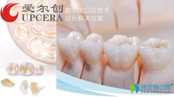 后磨牙做完根管治療后醫(yī)生推薦戴愛爾創(chuàng)瓷倍健全瓷牙套