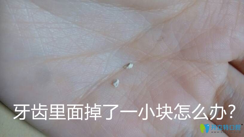 Duang！牙齒里面掉了一小塊怎么辦要補(bǔ)嗎