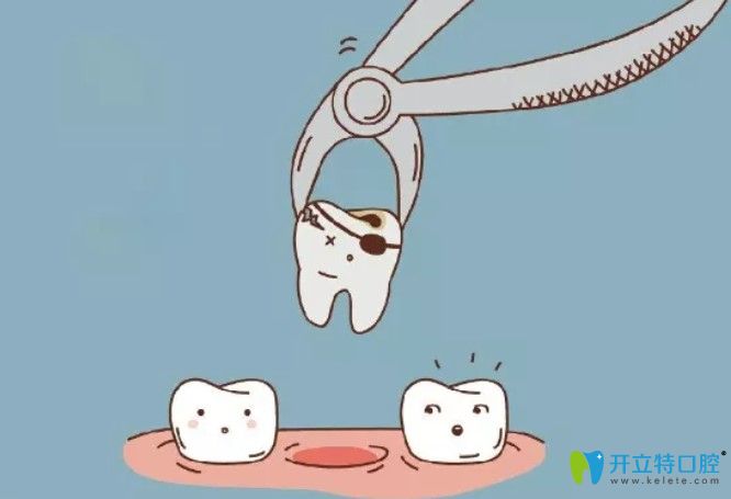 矯正為什么需要拔牙