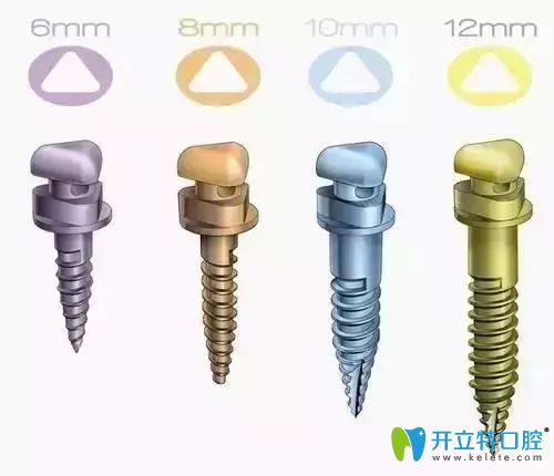 隱適美骨釘什么時(shí)候拔掉