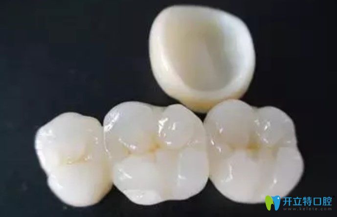 為啥牙醫(yī)建議做二氧化鋯全瓷牙，原來竟是因?yàn)檫@些...