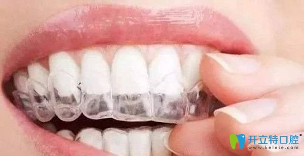 個(gè)別情況戴牙套是可以進(jìn)食的