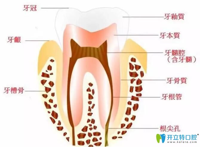 蛀牙修復醫(yī)生為啥建議我做根管治療而不是補牙呢？