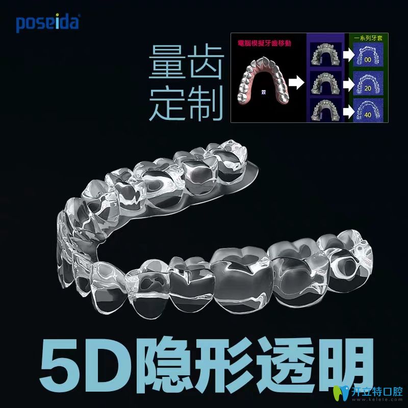 poseida博世達(dá)5D隱形牙套矯正牙齒效果怎么樣?這些內(nèi)幕要知道