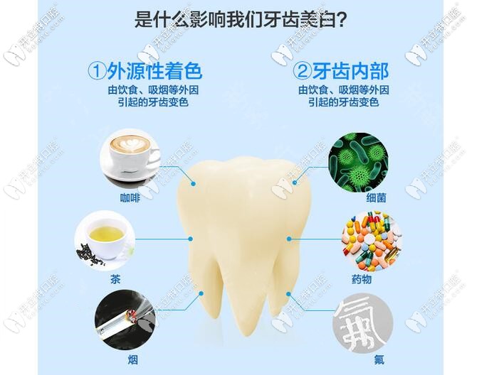 影響牙齒美白因素圖