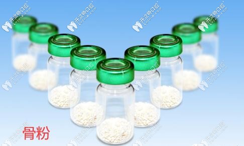 覺(jué)得種植牙填進(jìn)口Bioss骨粉價(jià)格貴的人建議看看與國(guó)產(chǎn)的區(qū)別