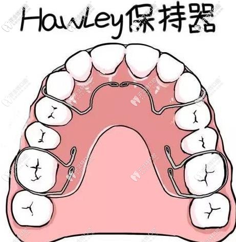 Hawley哈雷保持器的優(yōu)劣