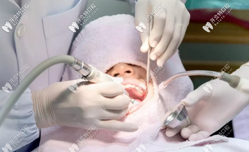 什么情況下需要做齦下刮治