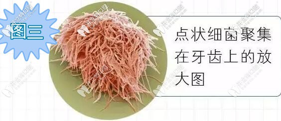 牙齒放大后上面的點狀細(xì)菌