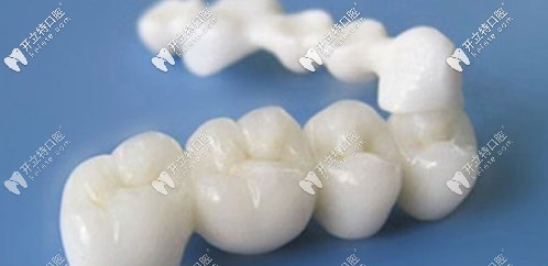 美白牙齒口?；顒娱_始了