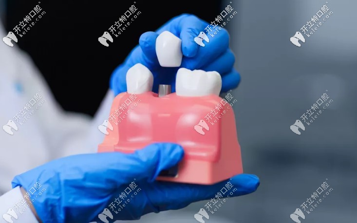 根管治療后為什么要戴牙冠