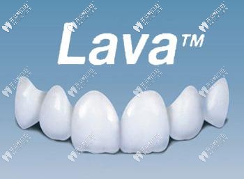 美國拉瓦全瓷牙