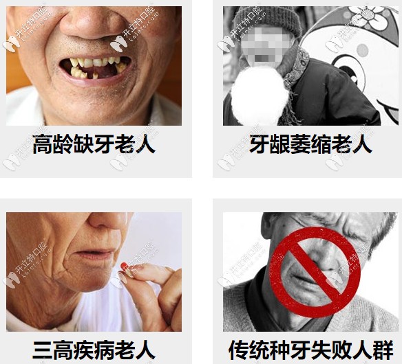 高齡缺牙、牙槽骨萎縮等都可以做種植牙