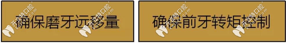 隱適美磨牙后推設(shè)計(jì)要點(diǎn)