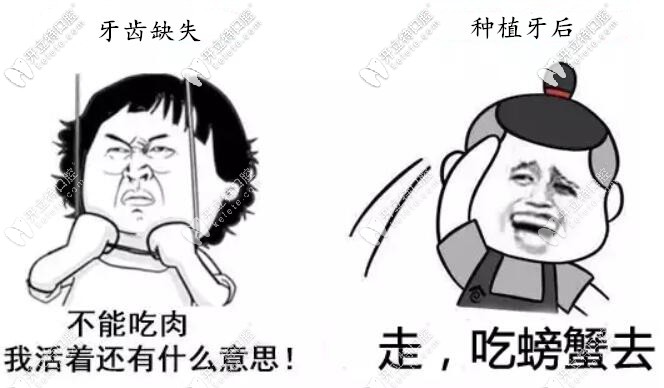 種植牙要使用一輩子,必須避開這4個(gè)坑選擇適合的種植體！