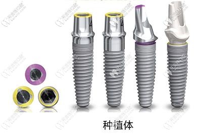 科普不同年齡的人做種牙時(shí),該怎么選擇種植體品牌？