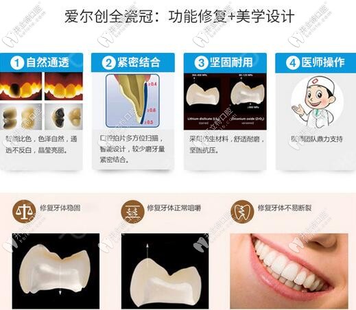 愛爾創(chuàng)瓷倍健全瓷牙優(yōu)勢(shì)