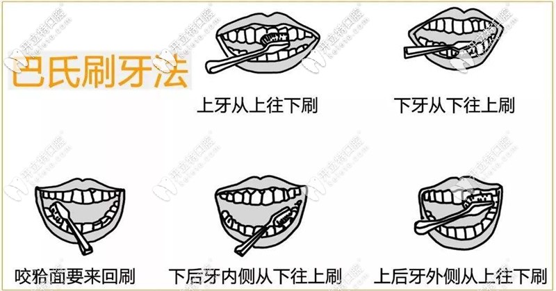 科學(xué)刷牙法—巴氏刷牙法