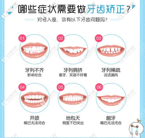 適合牙齒矯正的癥狀